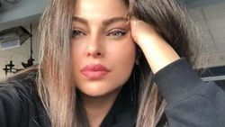 Sinem Umaş'ın kolları yandı
