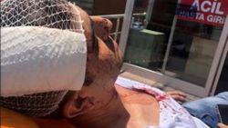Gazeteci Murat Alan saldırıya uğradı