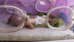Prematüre bebek Niyazi, 1 kilo 900 grama çıktı