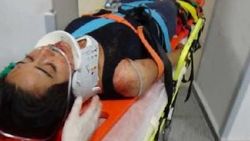 Aksaray'da bir kişi tartıştığı eşini boğazından bıçakladı