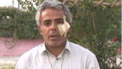 İHA muhabiri Şinasi İnan şarapnel parçasıyla yaralandı