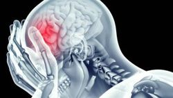 Epilepsi nöbetini 1 saat önceden tahmin eden yapay zeka