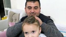 Kaybettiği el parmaklarının yerine ayak parmakları nakledildi