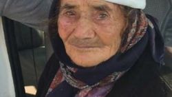Yabani hayvan tarafından yüzü parçalandı