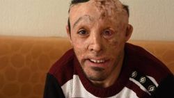 Mehmet Ali'yi ameliyat edebilecek doktor aranıyor