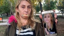 Güzellik uğruna hayatı karardı