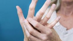 Raynaud fenomeni nedir