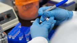 Koronavirüs test sonuçları e-Nabız'da
