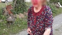 Ordu'da bir kişi yengesini balta ile yaraladı