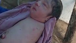 Hindistan’da kolları ve bacakları olmadan doğan bebek