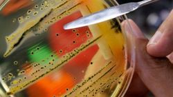 Kanada’da Salmonella alarmı