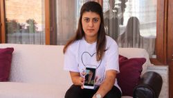 Diyarbakır'da lazer işlemi yaptıran genç kızın kolu yandı