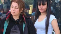 Yüzüne asit atan sevgilisini affeden Berfin: Çok pişmanım
