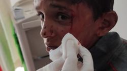 Van’da 10 yaşındaki çocuğa öldüresiye dayak