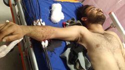 Sivas'ta YHT inşaatında koluna çelik tel saplanan işçi yaralandı