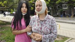 Eskişehir’de hayvanları beslerken darbedildi: Çenemde kırık var, platin takıldı