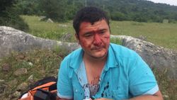 Kocaeli’de dayak yiyen muhabire yapılan çirkin yorumlar