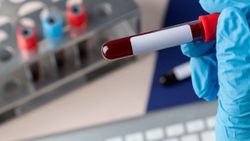 Anti HBS nedir