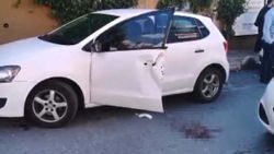Gaziosmanpaşa'da kazada parmakları kopan beyin cerrahı, zamanla yarıştı