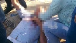 Mardin'de jandarmaya bombalı saldırı girişimi