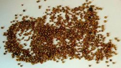 Şanlıurfalı adamın safra kesesinden 1200 taş çıktı