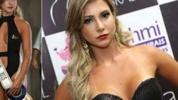 Estetik operasyon Brezilyalı modeli ölüme götürdü