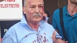 HDP'li eski başkan iki bombalı saldırıdan da sağ kurtuldu