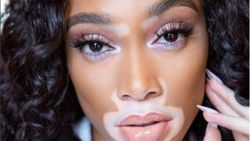 Winnie Harlow Victoria’s Secret meleği oldu