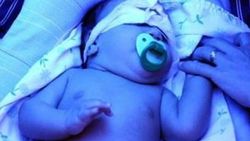 Mavi ışık hastası Poyraz bebeğe devlet yardım eli uzattı