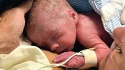İsveç'te rahim nakliyle bir bebek dünyaya geldi