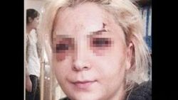 Dayak şikayetiyle polise giden kadın tutuklandı