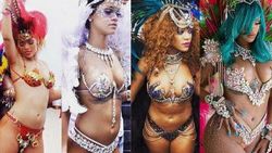 Kim derdi Rihanna bu hale gelecek