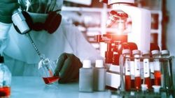 Fransa'da bakterili süt soruşturmasının belgeleri çalındı