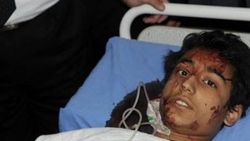 Şam'da okula havan topu düştü: 14 ölü