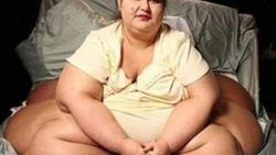 Dünyanın en kilolu kadını tam 378 kilo verdi