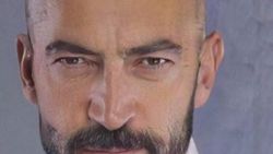 Kenan İmirzalıoğlu kel oldu