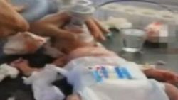 Suriye'de başında şarapnel parçası olan bir bebek doğdu