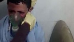 Klor gazından etkilenen Suriyeli çocuk yürek burktu