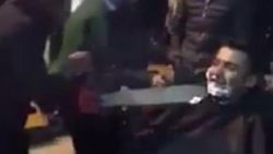Damadı hızarla tıraş ettiler