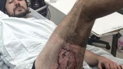 iPhone'u arka cebinde eridi