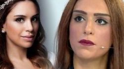 Tuğçe Ergişi estetik yaptırdı