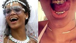 Rihanna'dan dişine özel aksesuar
