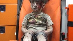 UNICEF: Halep'te Ümran gibi 100 bin çocuk var