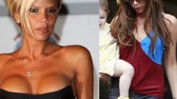 Victoria Beckham silikonlarından kurtuldu
