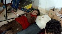 Madaya'da 16 kişi daha açlıktan öldü