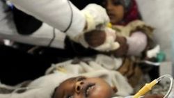 Yemen'deki kolera salgını