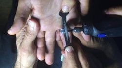 Şişen parmaktaki yüzüğü itfaiye çıkardı