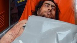 Bursa'da şizofreni hastası, annesini öldürdü