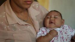 ABD ve Kanada'da Zika virüsü görüldü