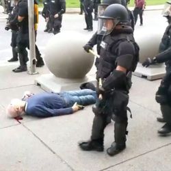 ABD polisi, yaşlı adamın kafasını yardı